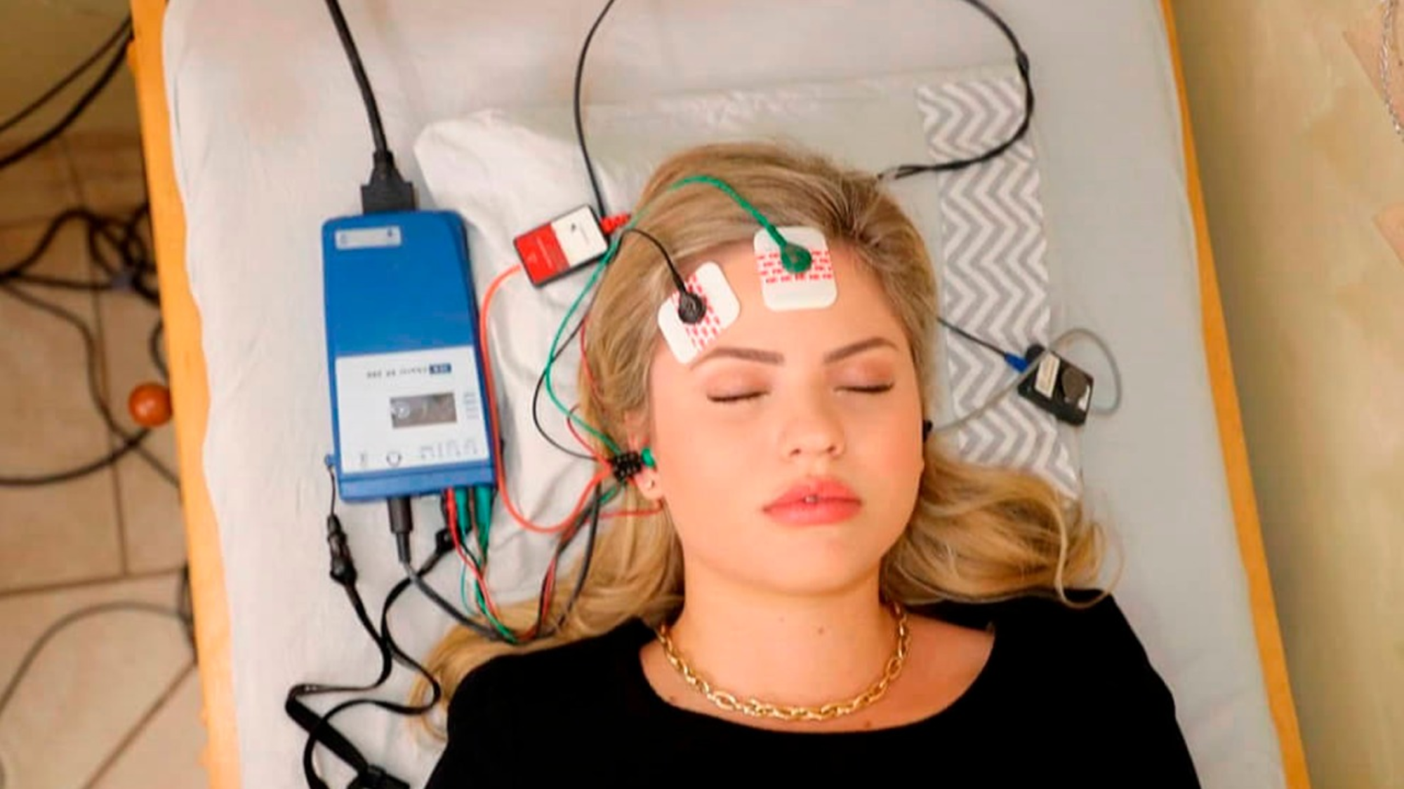 Exame de Eletrococleografia